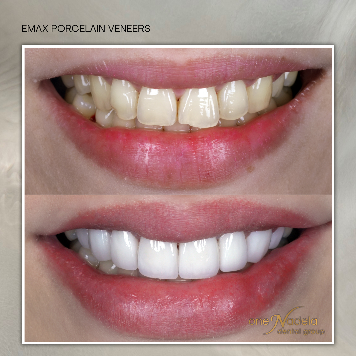 emax, 11_23 - dr, p18