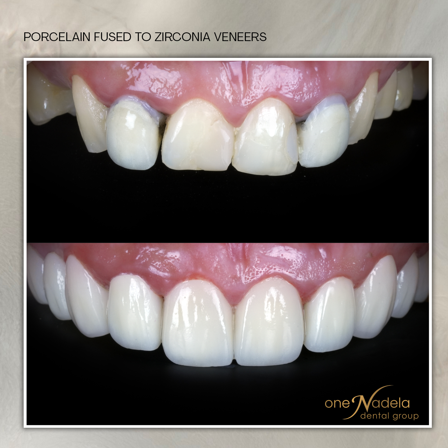 pfz, 11_9 - dy, p16,