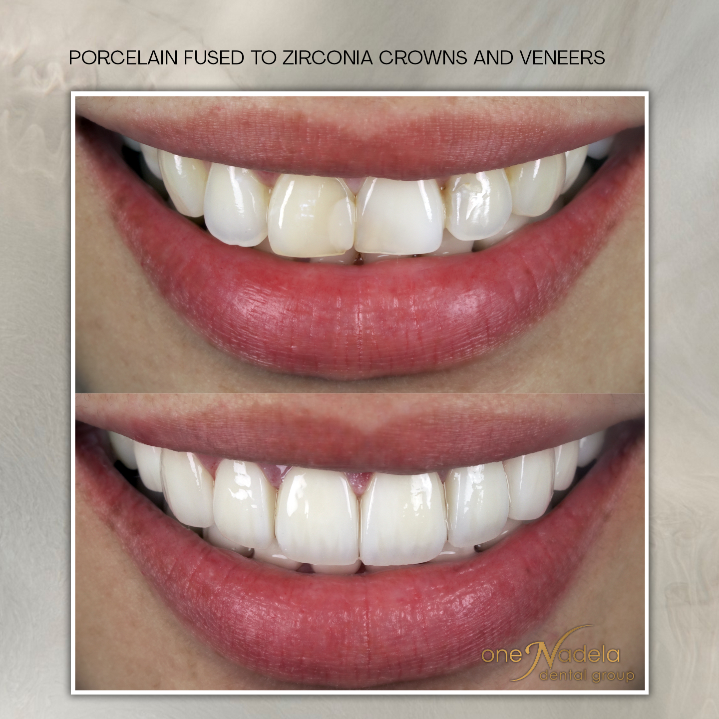 pfz a, 12_3 cebu, p10