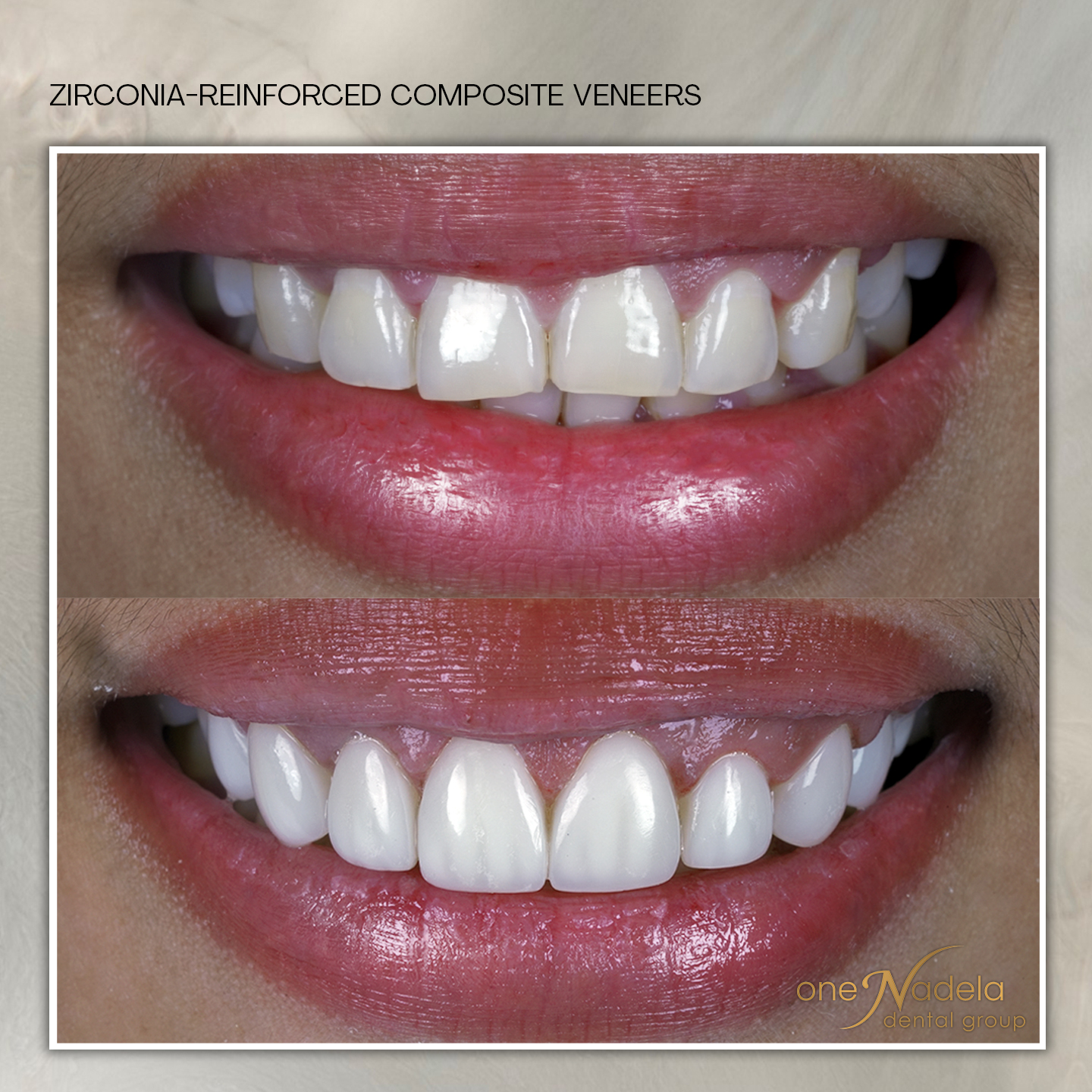 zrc, 10_15 b - dj, p9 a