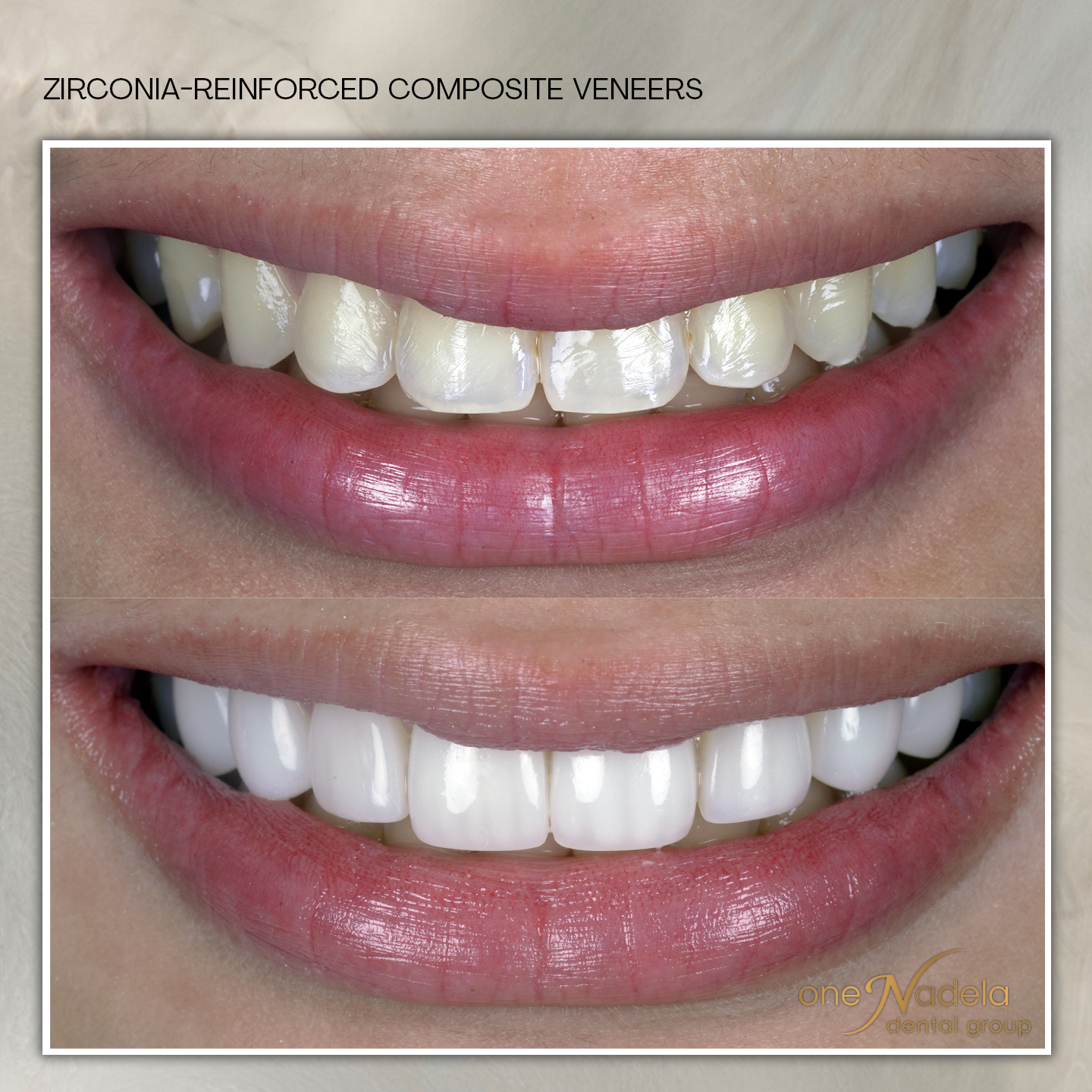 zrc, 10_22 a - dj, p10 b