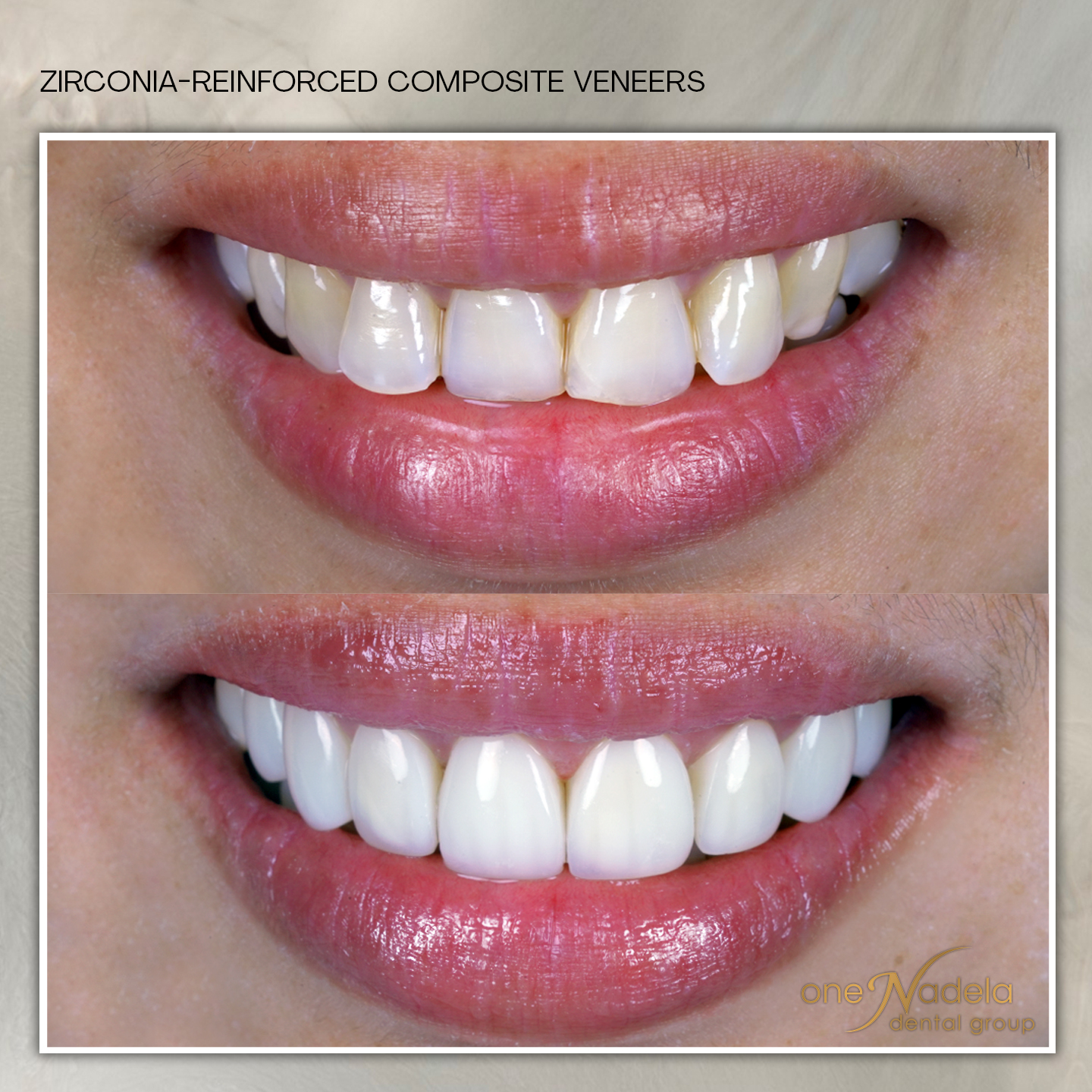 zrc, 10_8 - dj, p8 a