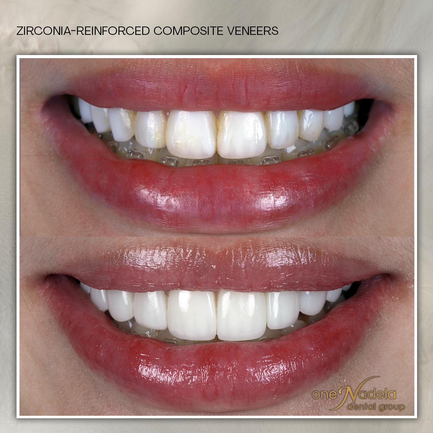 zrc, 11_26 - dj, p14